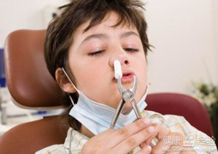 小兒過敏性鼻炎的治療方法