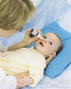 兒童副鼻窦炎怎麼去醫治