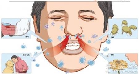 治療過敏性鼻炎患者怎麼做