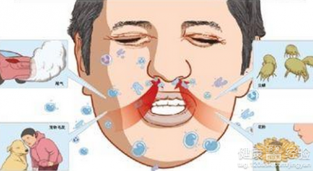 過敏性鼻炎的症狀有幾種表現