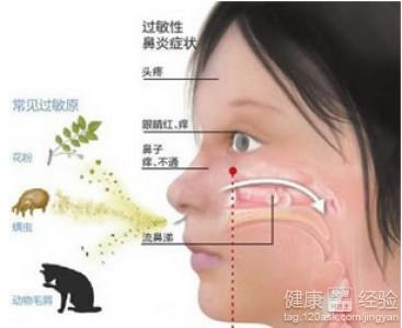 過敏性鼻炎怎麼去預防