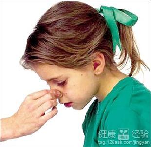 患上鼻炎怎麼辦？