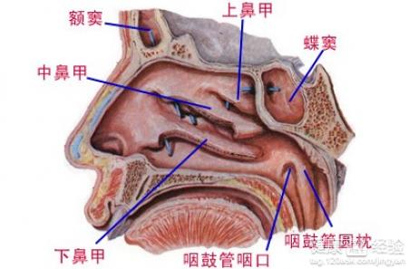 牙源性鼻窦炎的症狀