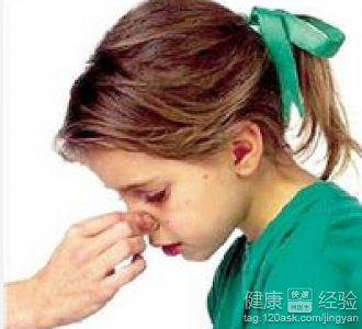 鼻窦炎會引起咳嗽嗎