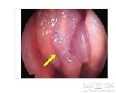 第1步