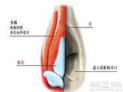 如果鼻中隔血腫怎麼辦