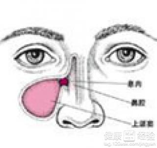 第2步
