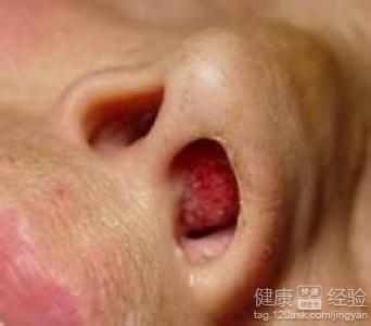 第2步