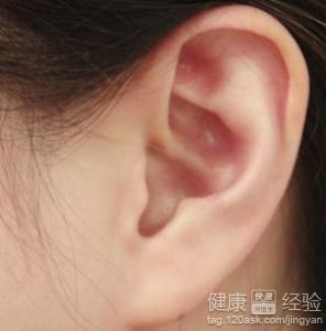 突發性耳聾耳鳴如何治療