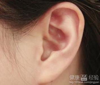 慢性中耳炎耳聾手術後如何做才能提高或恢復聽力