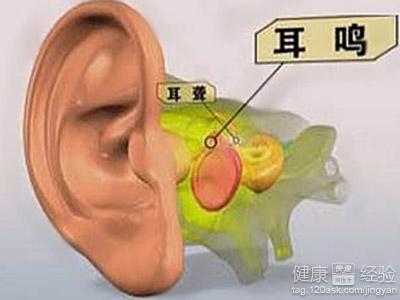 耳鳴怎麼治療