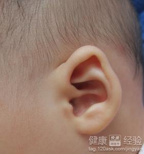 左耳朵嗡嗡叫需要最手術嗎