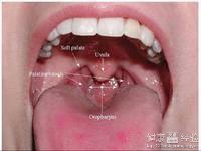 咽喉炎的主要的症狀？