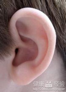 治療中耳炎的偏方有哪些