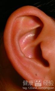 中耳炎的治療方法有哪些？