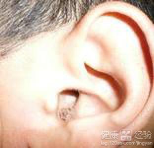 中耳炎的常見分類和症狀有哪些？