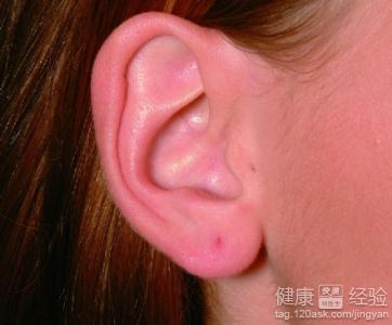 怎麼樣可以治愈中耳炎呢？