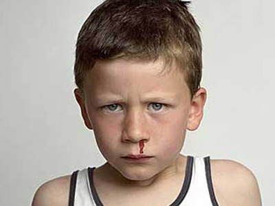 兒童鼻出血常見原因解析