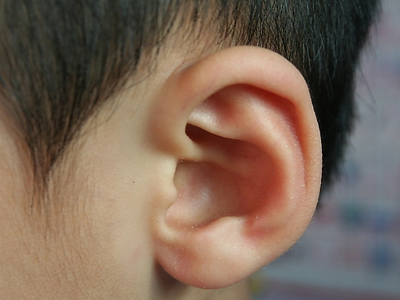 急性中耳炎的三大發病原因