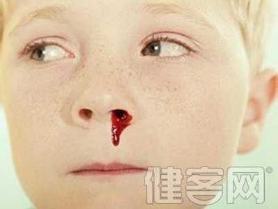 鼻出血的原因常見有哪些