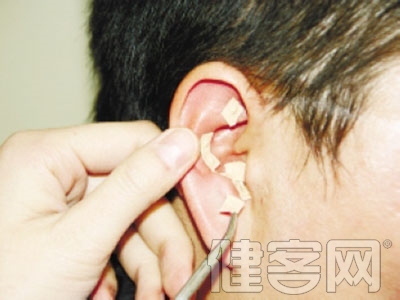常見的中耳炎的六種誘發因素