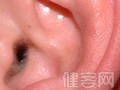 挖耳道可能導致外耳道炎的加重