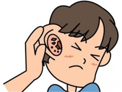 治療外耳道炎的偏方有哪些