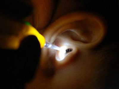 小蟲進入耳朵怎麼辦 小蟲入耳急救方法