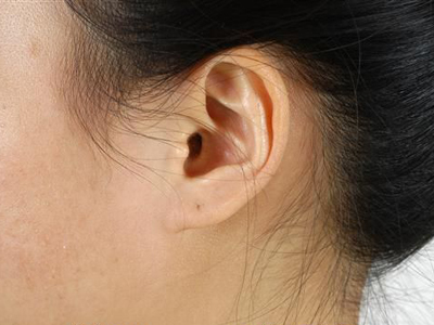 外耳道沖洗法的方法和禁忌
