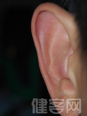 外耳道炎治療方法分析
