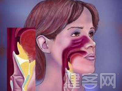 鼻息肉治療采用的兩種常見方法