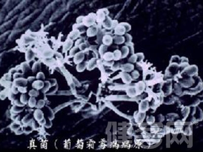 真菌性鼻窦炎做哪些檢查