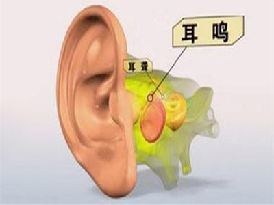 預防耳鳴的3大飲食療法