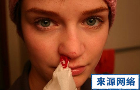 流鼻血怎麼辦 流鼻血怎麼止血 鼻出血止血方法