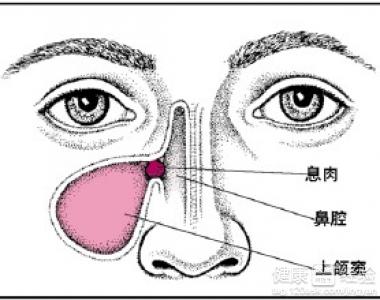 恢復鼻炎對大腦的損害機能有多大