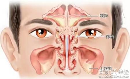 鼻窦炎症狀與治療方法