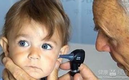 鼻內鏡下治療兒童分泌性中耳炎