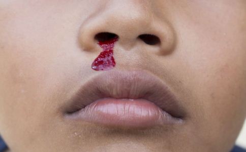 兒童為什麼會流鼻血 兒童流鼻血的原因是什麼 兒童流鼻血怎麼處理