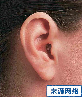耳聾患者 哪些人需要助聽器 助聽器